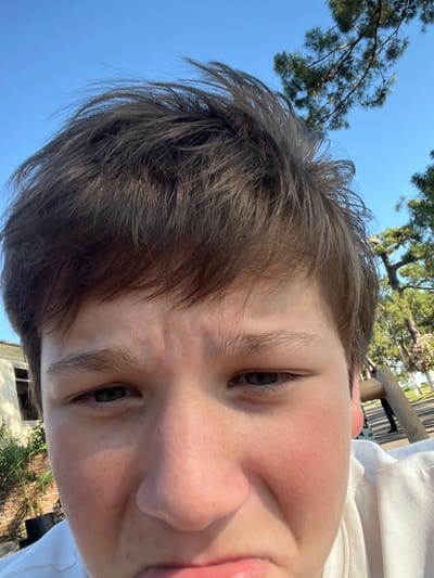 The image is a close-up selfie of a young person's face, with their hair and forehead filling the top half. The person's expression appears somewhat strained or pensive, with furrowed brows and narrowed eyes. The lighting suggests it is daytime, possibly outdoors, with the sun casting shadows and highlighting features. In the background, there are glimpses of trees with green foliage against a clear blue sky, and what appears to be a building with windows. The overall scene is natural and casual, typical of a personal photograph taken outside. No elements in the image definitively place the scene in Ochamchire, Abkhazia.