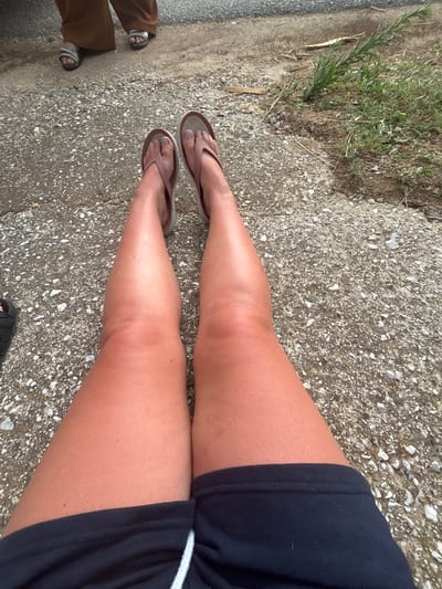 The image shows a close-up, overhead view of a person's legs and feet sitting on a gravel and concrete surface. The person is wearing dark blue shorts and brown flip-flops. Their legs appear sun-tanned. In the background, another person wearing brown pants and sandals is visible. The environment appears to be outdoors, with some grass and dry vegetation to the right. There is no specific indicator of the location within the city of Prosotsani Municipal Unit, Greece.