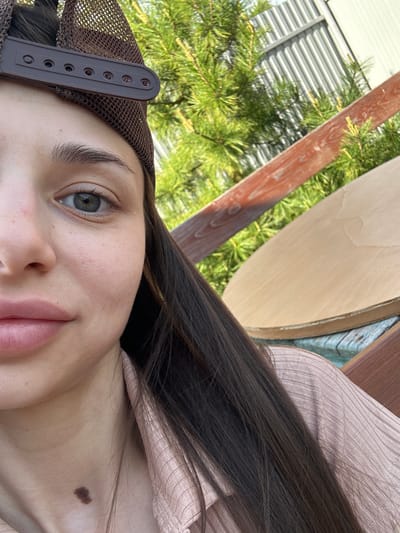 A close-up, tilted perspective photograph shows a young woman's face and upper torso. She has light skin, dark brown hair, and light-colored eyes. She wears a brown mesh baseball cap. A large mole is visible on her upper chest. The background includes green foliage, what appears to be a metal corrugated structure, a wooden beam, and a light-colored wooden surface. The location, Ludorvai, Russia, cannot be verified by the visual information alone.