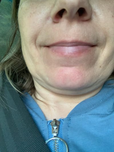 A close-up, waist-up, portrait of a middle-aged Caucasian woman's face and upper chest is captured. She is wearing a blue hooded sweatshirt with a zipper, a seatbelt strap is visible on the left side of the frame. Her mouth is slightly open, and her lips appear full and reddish. The lighting is somewhat harsh, casting shadows that highlight the texture of her skin, including visible pores and fine lines around her nose and mouth. Her hair, a medium brown with lighter streaks, is visible on the left side of the image. The background is dark and indistinct. The scene appears to be indoors, possibly in a vehicle, given the presence of the seatbelt. There is no identifiable information about the location within Мядзельскі сельскі Савет, Belarus, as the image lacks any contextual or geographical markers.