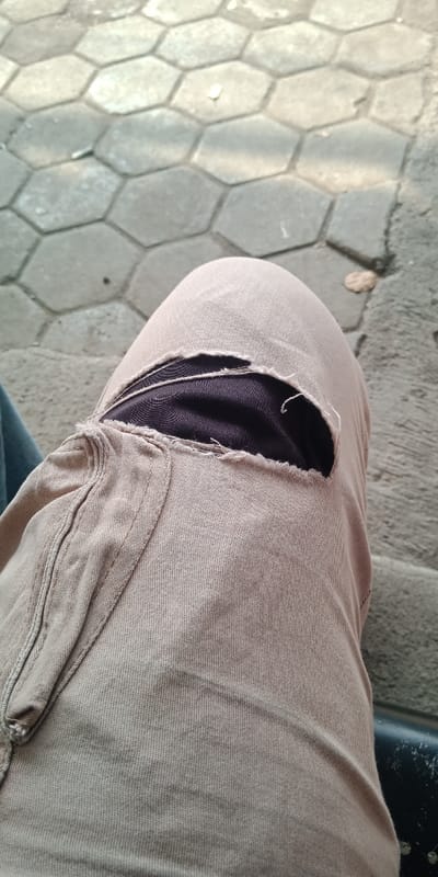 A close-up, downward-angled view captures a human leg, likely the right, resting in what appears to be a seated position. The leg is clad in light brown (tan or khaki) trousers, which feature a significant, irregular tear across the knee area, revealing a dark fabric or garment underneath. The edges of the tear are frayed. Partially visible to the lower left is a segment of a blue or dark green garment, possibly a second leg or another part of the attire. The background consists of grey hexagonal interlocking paving stones, characteristic of an outdoor or semi-outdoor pedestrian area. Minor debris, possibly small dried leaves or dirt, is scattered on the pavement. A dark, black object, potentially a chair armrest or bench component, is partially visible at the bottom right. The scene is illuminated by natural light. The location is Bojongherang, Indonesia.