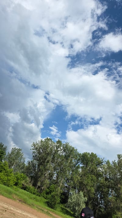 The image shows a bright, partly cloudy sky over a wooded area and a grassy slope. The trees are tall and lush green, with some lighter foliage interspersed. The sky is a vibrant blue with scattered white and grey clouds, suggesting fair weather with a possibility of rain. The ground in the foreground is a mix of dry, brown dirt and green grass, indicating a natural, outdoor setting. The overall impression is a scenic view, likely in a rural or park-like environment. There is a partial view of a person's head and shoulders wearing a black cap with a red and white emblem at the bottom right of the image. The location is specified as Дарьино, Russia, though no specific landmarks or city features are visible to confirm this within the image itself.