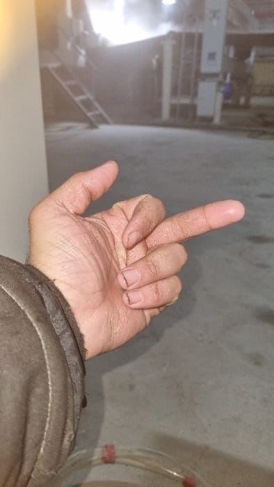 A person extends their middle finger, a gesture considered offensive, towards the camera. The hand appears weathered, with dirt under the fingernails. A dark jacket sleeve is visible in the lower right. The background is blurred, showing what seems to be an industrial site or a large piece of machinery and a gray wall. A transparent hose with red bands is visible in the upper right corner.