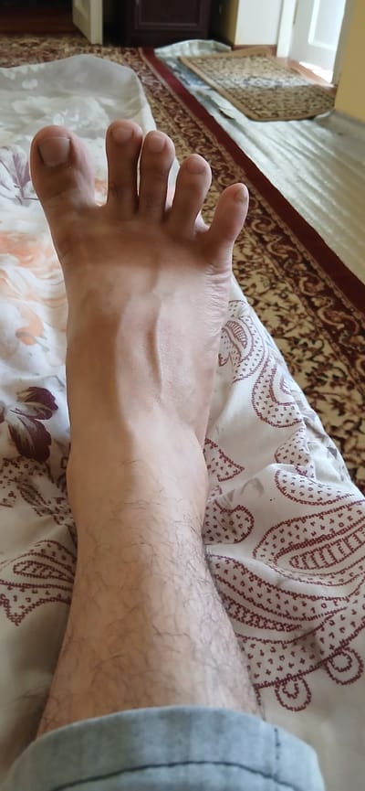 The image shows a close-up view of a bare foot and lower leg resting on a patterned fabric. The foot is positioned with the toes pointing upwards, revealing five toes with visible toenails. The skin on the foot appears smooth, with prominent veins visible on the top of the foot and arch. The lower leg is covered in dark hair. The fabric beneath the foot has a white background with a repeating paisley or floral pattern in a dark reddish-brown color. In the background, a patterned rug is visible on the floor, along with a portion of what appears to be furniture and a doorway. The lighting suggests an indoor setting. The image is focused on the foot and lower leg, with the background out of focus.