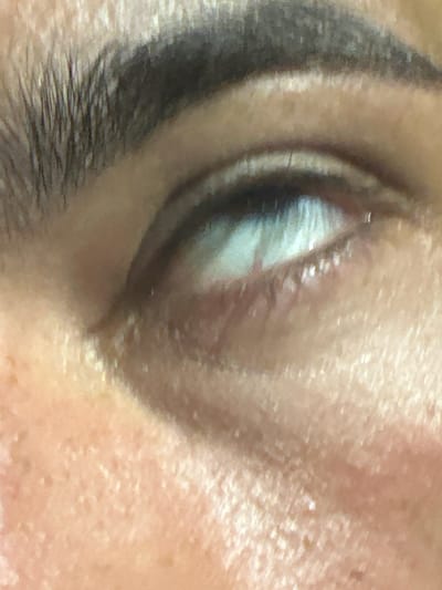 The image is a close-up, high-angle shot of a person's eye, showing the eyebrow, eyelid, and sclera of the eye. The skin appears to have a textured surface with some small blemishes. The eyebrow is dark and well-defined. The sclera of the eye is visible, with a bright reflection on its surface. The image does not provide any information about the location in the city of El Masnou, Spain, or any specific context regarding people, subjects, objects, actions, or interactions.