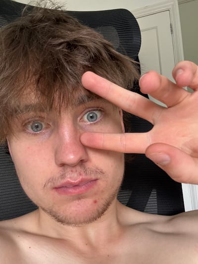 A young man is viewed from an unusual low angle, possibly reclining. His face is framed by brown hair and a sparse beard. His eyes, a striking blue-grey, are prominent. One hand is raised, with the index finger touching the tip of his nose and the middle finger close to one eye. A black mesh chair is visible in the background, along with a glimpse of a white door. His skin appears fair, with a few visible blemishes.