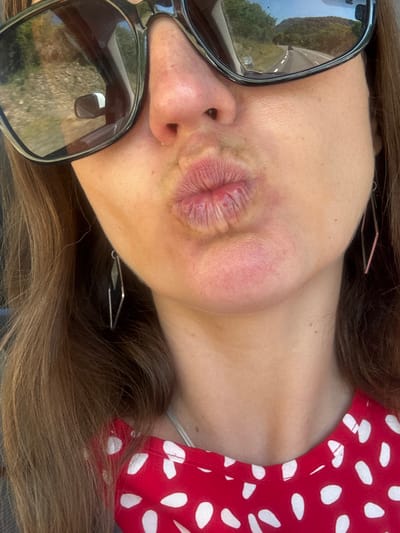 The image is a close-up, horizontally oriented, selfie-style photograph. The main subject is a person's face, specifically their mouth pursed in a kiss and part of their nose, wearing dark-rimmed sunglasses. The person's skin appears smooth with some texture visible. Their lips are slightly dry and parted. A red top with a white polka dot pattern is visible on the right side of the frame, along with some of the person's brown hair. The sunglasses reflect a sunlit outdoor scene with greenery and what appears to be a road. A glint of metal, possibly a hair accessory, is visible near the person's ear. The lighting suggests it is daytime, likely sunny given the reflection. The image is taken from a low angle, looking up at the subject. No text is visible in the image. The location context is Lavans-lès-Saint-Claude, France.