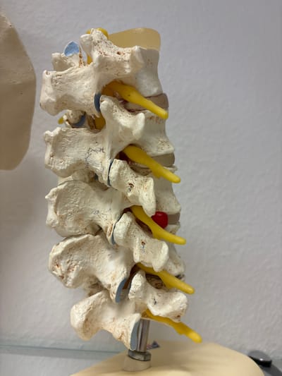 The image shows a close-up, side view of a medical model of a human lumbar spine. The model is made of white material, likely plastic, and depicts several vertebrae connected by yellow spinal nerves and a red intervertebral disc. The vertebrae have textured surfaces and some show blue accents on their joints, simulating cartilage. The model is mounted on a metal rod, partially visible on the right side, and is set against a plain, light-colored background, possibly a wall. The lighting appears to be bright and even, suggesting an indoor setting with artificial light. There is no visible text in the image. The focus is on the anatomical detail of the spine model.