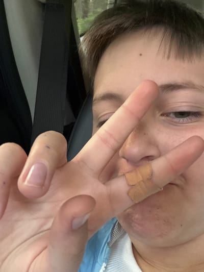 An individual is shown close-up, face slightly angled, making a peace sign. The ring finger of the hand has a band-aid. The person has short brown hair, light skin, and brown eyes. A mole is visible on the left cheek. Below the individual is a black seatbelt. A blue garment is partially visible.