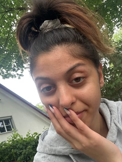 A young woman with brown hair pulled into a messy bun is captured in a close-up, outdoor selfie. She is wearing a grey hooded sweatshirt. Her right hand is placed over her mouth, with her manicured fingernails, featuring a French tip with dark blue accents, visible. The background shows lush green foliage and the side of a white building with a window, consistent with a residential area. The scene suggests a casual, everyday moment. The lighting indicates it is daytime. The context of Augsburg, Germany, implies this scene is located within the city limits.