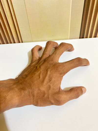 A tanned human hand with prominent veins is positioned against a white surface. The fingers are slightly curled. To the left of the hand is a wall with horizontal brown and beige stripes. The photograph was taken indoors, with no specific identifying information linking it to Tanjongkapai, Indonesia.