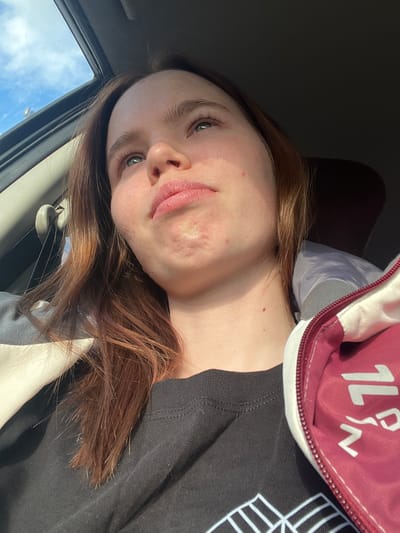 A tilted medium shot captures a young woman inside what appears to be a car, looking directly at the camera. She has long, reddish-brown hair that cascades over her shoulders and against a dark t-shirt. Her eyes are a light color, possibly blue or green, with full eyebrows. Her expression is neutral and calm, perhaps slightly pensive. Visible on her skin are natural textures, including pores and some minor blemishes or marks on her cheek and chin area.
She is wearing a dark, possibly black, t-shirt. Over her right shoulder (viewer's left), part of a red and white zippered item, resembling a jacket or bag, is visible. White text on this red fabric clearly shows "1L" followed by stylized characters that could be interpreted as "%" or "PN".
The setting is an automobile interior, with a bright car window to her left revealing a clear blue sky dotted with white clouds, indicating it is daytime with fair weather. The interior of the vehicle is otherwise dark, with natural light illuminating her face from the side. The overall scene suggests a candid moment within a vehicle in Russkie Kirmeni, Russia.