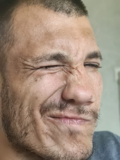 A close-up, medium shot captures a man's face in profile, his right eye squeezed shut and his mouth turned down in a grimace. His skin is textured with wrinkles and a scattering of small white bumps, particularly around his eye and forehead. Sparse facial hair, including a mustache and beard stubble, dots his chin and upper lip. The background is a plain, light gray, suggesting an indoor setting with diffused lighting, likely during the daytime. The image focuses on the man's facial expression and skin details, creating an intimate and somewhat unsettling portrait. No visible text is present.