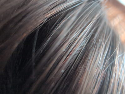 The close-up, macro image displays a dense arrangement of dark brown and lighter brown/grey strands of hair. The lighting suggests an indoor setting, with some strands catching the light, creating a sheen and revealing subtle hints of reddish-brown undertones. Scattered amongst the hair are small, light-colored specks, possibly dandruff or styling product residue. The perspective is extremely close, focusing on the texture and fine details of the hair itself. The overall impression is one of a detailed examination of hair. There is no visible text, nor are there any cues about the time of day, weather, or specific emotions. The location context of Słupsk, Poland, does not provide any visual information within the image itself.