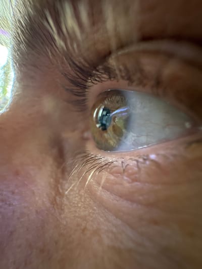 A close-up image of an eye. The eye is surrounded by skin and eyelashes. There is a reflection in the eye of what appears to be an interior space. There is no information about the location or a city of Ketoshi, Russia in this image.
