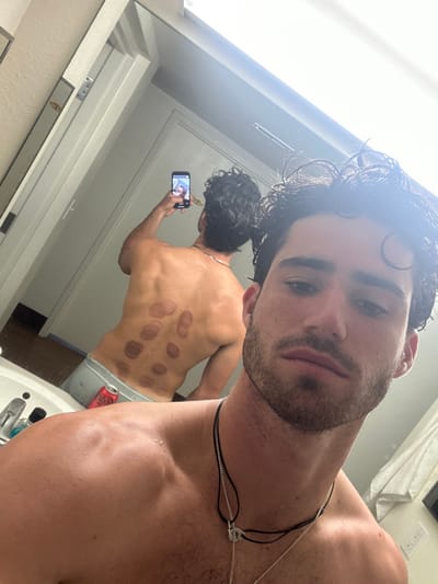 This image depicts a male individual taking a mirror selfie in a bathroom located in Miromar Lakes, United States. The foreground shows the subject from the chest up, featuring dark, wet, curly hair, facial stubble, and two necklaces (one black string with a silver clasp, one silver chain). He is bare-chested. The reflection in the mirror reveals his back, which displays approximately ten distinct circular, reddish-purple marks consistent with cupping therapy, distributed across his upper and mid-back. He is seen holding a smartphone in his right hand, extended behind his head, capturing the reflection. He is wearing light grey boxer briefs, partially visible in the reflection. A white bathroom sink counter occupies the lower left foreground, adorned with a faucet, various toiletries, and a red and white beverage can. A white door is visible in the background reflection.