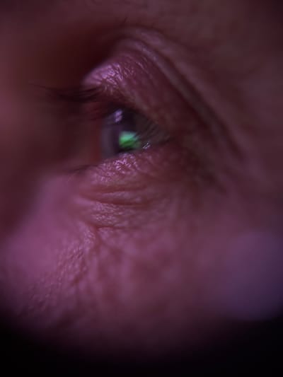 This is an extreme close-up, macro photograph of a human eye, angled from the side. The skin surrounding the eye, including the eyelid and under-eye area, is wrinkled and textured, illuminated by a soft pinkish-purple light. The iris of the eye appears dark, with a faint green reflection visible in the pupil. Eyelashes are visible along the upper eyelid. The background is dark and out of focus. There is no information in the image that suggests a specific location in Biržai, Lithuania, or any urban environment. The scene is isolated to the subject's eye.