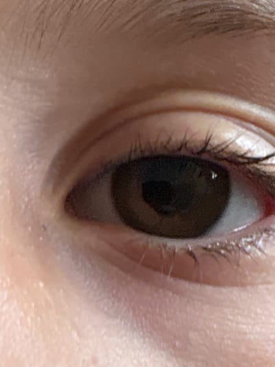 A close-up shot of a human eye, showing the iris, pupil, eyelashes, and surrounding skin. No context indicates a specific location like Damianitsa, Bulgaria.