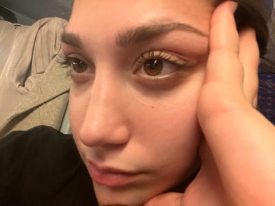 A close-up, slightly blurred image of a woman's face. The image is rotated counterclockwise. Her eyes are brown and wide open. A hand touches the left side of her face, obscuring some features. Her lips are visible at the top of the frame, and her nose is prominent. A gray-beige garment is visible on the right side of the image. The skin appears smooth and light-toned.