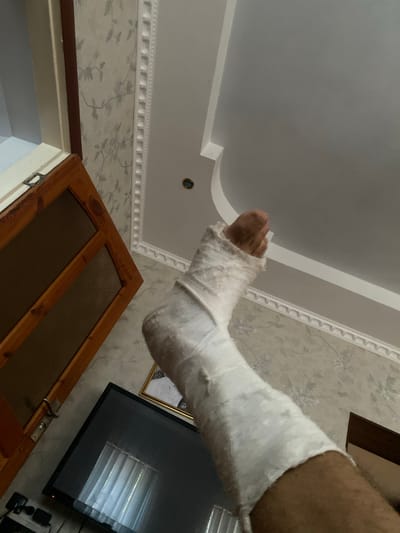 An indoor scene features a person's lower leg and foot, encased in a white cast, extending from mid-shin down to the toes. The cast appears to be made of plaster or fiberglass. The foot is pointed slightly upwards. In the background, a wall with a floral wallpaper pattern is visible, topped by decorative white molding. A wooden cabinet with glass panels is to the left, and a television set is below it. The ceiling is also visible, painted in a neutral color with some architectural detailing. The image is taken from a low-angle perspective, looking upwards at the casted leg. The location is identified as a village in the Oytal rural district of Kazakhstan.