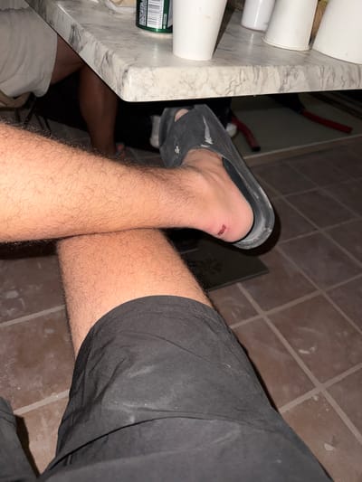 In Miraverde, Spain, a person's legs are visible, with one leg resting on the other. The person is wearing black shorts and a black slide sandal on their right foot. There is a small wound on the back of the right heel. The scene takes place indoors, with a tiled floor and a marble-patterned countertop in the background. Several white cups and a can are on the countertop.