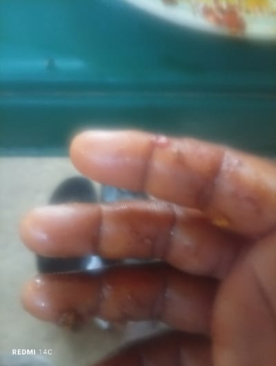 A close-up shot features a human hand, likely belonging to an adult with a dark skin tone. Four fingers are prominently displayed, appearing wet or coated with a glistening substance, possibly oil or food residue, with small yellowish and reddish/brownish specks visible on the skin. A minor reddish mark or superficial cut is present near the knuckle of the uppermost visible finger. The background is largely out of focus, showing blurred teal and lighter tones, consistent with an indoor setting, possibly a kitchen. The image was captured in Ushapa, Nigeria. The text "REDMI 14C" is visible as a watermark in the bottom-left corner of the frame.