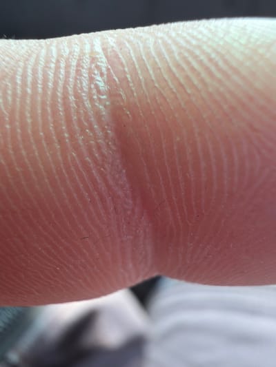 This is a close-up, macro photograph of the skin on a human finger. The intricate ridges and lines of a fingerprint are clearly visible, showing the typical pattern of whorls and ridges. There are a few very fine dark hairs or debris present on the surface of the skin. The lighting highlights the texture and subtle color variations of the skin, which appears healthy and somewhat translucent. The background is out of focus, suggesting a shallow depth of field, and appears to be a blurred interior or possibly outdoor environment. There are no specific indicators to place this image in the city of Střítež, Czechia.