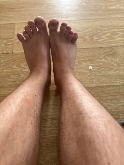 The image shows a pair of bare feet and lower legs, resting on a light brown wooden floor. The feet are positioned upright and slightly spread apart. The skin on the feet and legs is light-toned and shows some redness, particularly on the lower legs, possibly indicating irritation or minor injuries. The legs are covered in light, short hair. The floor has a visible wood grain pattern. There is no indication of the specific location in the city of Malaya Tsarevschina, Russia.