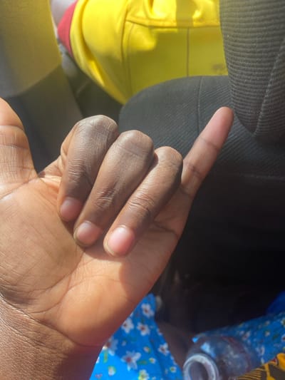 The scene depicts a close-up of a human hand, dark in complexion, making a "shaka" or "hang loose" gesture with the thumb and pinky finger extended and the middle three fingers curled inward. The fingernails are short and appear natural, without polish. The hand is illuminated by strong, directional light, casting shadows. In the upper background, a section of yellow fabric is visible, possibly part of an article of clothing or a bag. To the right, a dark, ribbed fabric, consistent with vehicle upholstery, is present. In the lower right, a blue fabric with a white floral pattern is visible, upon which rests a transparent plastic bottle with a white cap. The environment suggests an interior setting, likely within a vehicle, located in Unguwar Gaya, Nigeria.