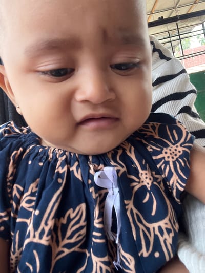 A close-up, downward-angled, outdoor shot captures a baby with a shaved head and fair skin, wearing a dark blue dress with a floral pattern and a white ribbon. The baby's face is partially obscured by the angle, showing one eye, a nose, and a mouth. Behind the baby, a person in a black-and-white striped garment is visible. The background reveals a tiled roof, metal framing, and greenery, suggesting an open-air setting in Seumirah, Indonesia. The overall lighting is natural and appears to be daytime.