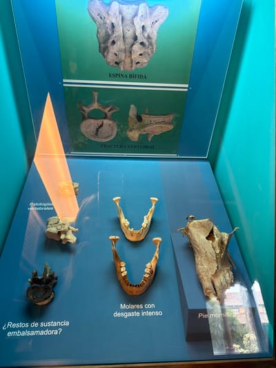 The image displays an exhibit of anatomical specimens, likely in a museum or educational setting. The main subjects are various skeletal parts, including what appears to be a mummified foot, jawbones with visible teeth, and vertebrae exhibiting different conditions. One display card labels a mummified foot as "Pie momificado," and another discusses "Molares con desgaste intenso" (Molars with intense wear). There are also labels for "ESPINA BÍFIDA" (Spina bifida) and "FRACTURA VERTEBRAL" (Vertebral fracture), suggesting educational content related to spinal conditions and injuries. The final visible label asks "¿Restos de sustancia embalsamadora?" (Remains of embalming substance?), indicating a display about mummification or preservation techniques.
The setting is an indoor display with a blue background. A diagonal beam of orange light cuts across the lower portion of the image, suggesting directional lighting or a spotlight. The exhibit is behind a protective barrier, possibly glass, as reflections are visible on the surface. The overall impression is one of a scientific or historical presentation of biological and pathological specimens. The specific location cue "La Cuesta, Spain" is not directly visible within the image itself, but it provides context for the origin or subject of the exhibit. No people are visible in the image, and there are no cues about the time of day or weather.