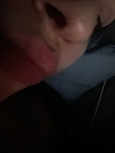A close-up, poorly lit image shows a person's nose, lips, and part of their cheek. The skin appears smooth. A section of denim fabric can be seen in the background above and to the right of the face. The rest of the background is predominantly black.