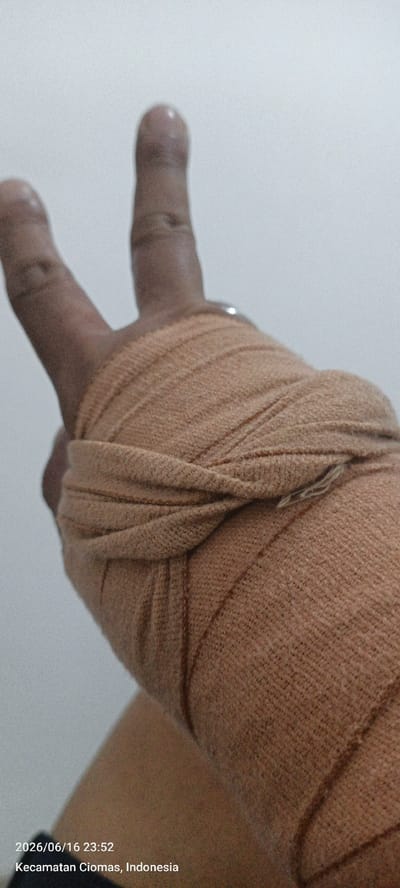 The image shows a close-up of a person's hand and forearm wrapped in a beige elastic bandage. Two fingers, the index and middle fingers, are extended upwards in a peace sign gesture. The bandage is wrapped tightly, covering a significant portion of the wrist and forearm, with visible overlapping layers of the fabric. A small, metallic ring or band is visible on one of the fingers. The background is a plain, light-colored wall. The bottom of the image displays a timestamp "2026/06/16 23:52" and a location "Kecamatan Ciomas, Indonesia".