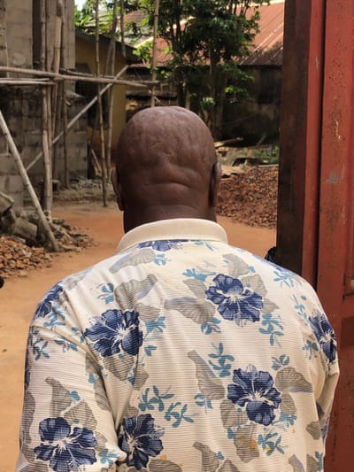 The image displays an adult individual, viewed from the rear, standing outdoors in Abagana, Nigeria. The subject has dark skin, a bald head with noticeable scalp undulations, and is wearing a cream-colored, ribbed polo shirt. The shirt features a repeating pattern of blue and light blue floral designs with greyish-green leaf motifs; a white collar is visible.
The ground surface is composed of reddish-brown earth. In the left background, an incomplete structure built with grey concrete blocks is visible, encircled by scaffolding constructed from wooden poles. Piles of reddish-brown debris are present near this construction. Further in the background, trees and vegetation are evident, along with a building featuring a terracotta-colored corrugated metal roof. A dark reddish-brown vertical structure, possibly a metal gate or frame, is partially visible on the far right edge of the frame. Another pile of reddish-brown material is situated in the background to the right of the subject's head. The scene is illuminated by natural daylight.