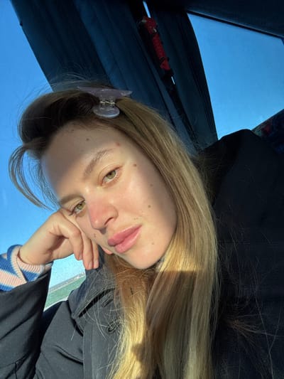 A female individual is depicted in a close-up, head-and-shoulders shot inside a vehicle, likely a bus or train, in Скідзельскі сельскі Савет, Belarus. Her fair skin shows numerous freckles and moles, with minor blemishes visible on her forehead and left cheek. She has green eyes and long, blonde hair, secured at the top with a translucent light purple claw clip. She is wearing a dark jacket over a striped blue and light pink garment. Her head is slightly tilted, and her left hand supports her chin/jaw. She gazes directly at the viewer with a neutral expression. Strong sunlight from the left illuminates her face and hair, creating pronounced highlights and shadows. Through the vehicle window, a clear blue sky is visible. Dark interior elements, including what appears to be a window frame or curtain and a red object with straps, are present in the background.