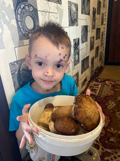A young boy with purple markings on his face and neck holds a white bucket filled with large mushrooms. He is wearing a blue t-shirt. The background shows a patterned wallpaper with images resembling old telephones and clocks, and a portion of a rug is visible in the lower right corner. The overall impression is an indoor setting. The location is identified as Ihnatpil, Ukraine.