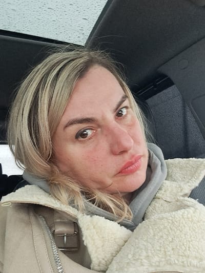 The image displays an adult female situated inside a vehicle, likely a car, in Staraya Kupavna, Russia. She possesses fair skin, light blonde hair, and brown eyes, directing her gaze towards the camera. Her lips are slightly downturned, and her facial skin, particularly on the cheeks and around the nose, shows some redness. She is dressed in a light grey hooded sweatshirt, worn under a beige or cream-colored jacket featuring a visible shearling-like interior or collar, a metallic zipper, and a silver-toned buckle detail on the left side. The background details include the dark grey interior roof lining of the vehicle. Above her head, a section of a window or sunroof is visible, covered uniformly with small water droplets, indicating precipitation. A dark mesh sunshade is partially visible to the right, adjacent to the roofline.