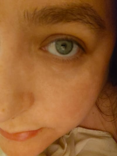 This is a close-up, uncropped image of a person's face, focusing on the right eye, nose, and mouth. The eye is a light green color with a dark pupil. The skin is fair and appears smooth, with some freckles visible on the cheek. The person has dark eyebrows and a hint of dark hair is visible on the right side of the frame. The background is blurred and appears to be a light-colored fabric, possibly clothing or bedding. The image is taken from a slightly downward angle. There is no discernible urban environment or specific location within Azor, Israel, depicted in this image.