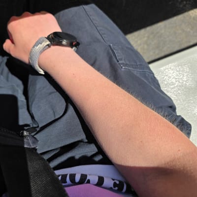 A close-up shot shows a person's right arm and hand resting on their lap. The arm is fair-skinned with visible fine hairs and appears slightly sun-kissed, with a faint shadow cast across it. A smartwatch with a grey and white patterned band is worn on the wrist. The person is wearing dark blue cargo pants, with a hint of a patterned shirt visible beneath. The background consists of dark fabric, possibly part of a bag or clothing, and a textured surface that suggests a bench or seat. The image is taken outdoors, indicated by the strong sunlight and shadows. The location is not specified in the image itself.
