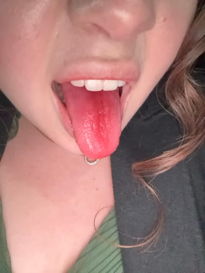 A close-up image, stated to be located in Cacalomacan, Mexico, depicts the lower face and upper chest of an individual. The subject's mouth is open, with a red, moist tongue extended forward. The upper row of white teeth is visible. A thin, silver-colored chain necklace with a small, circular pendant featuring small, reflective elements rests on the lower neck. The individual's skin appears fair, with light-colored hair, possibly brown or auburn, visible on the right side of the frame. Clothing consists of a green, ribbed fabric on the left side, and a darker, plain fabric on the right, framing the neck. No other individuals are present. No specific environmental details identifying Cacalomacan, Mexico are visible within the limited scope of the frame.