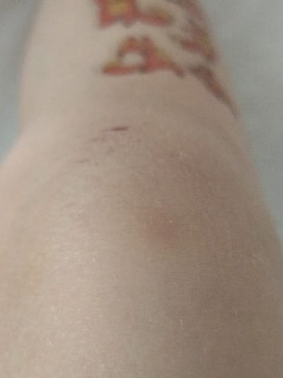 This is a close-up, out-of-focus photograph of human skin. The skin appears to be a light to medium tone. There are faint red marks and some discoloration on the surface. In the upper portion of the image, there is a blurred hint of what appears to be a tattoo with red and yellow elements. The lighting is diffuse and the overall quality of the image is grainy. The image does not contain any elements that would allow for its localization to the city of Vysokyi, Ukraine, or any other specific geographic location.