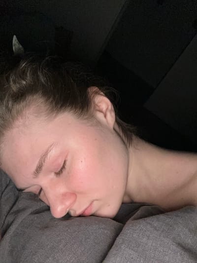 In Tashevka, Russia, a close-up, dimly lit image depicts a person, presumably female, with light skin tone and brown hair, resting or sleeping on a grey fabric surface, likely bedding. The individual's eyes are closed, and the right side of the face is pressed against the fabric. The skin on the face, neck, and forehead exhibits a slight sheen, consistent with perspiration. A light-colored, pointed object, possibly a hair accessory, is visible embedded in the hair near the crown of the head. The background is dark and indistinct, suggesting low ambient light within an enclosed space.