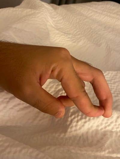 The scene, located in the City of Albany, United States, depicts a human left hand with a medium-dark skin tone and fine hair on the dorsal surface, resting on a white, textured fabric, consistent with bed linen. The hand's fingers are partially flexed; the index and middle fingers are notably curved, forming a U-shaped void between their tips and the palm area. The lighting is warm and ambient, producing soft shadows on the textured background and beneath the hand.