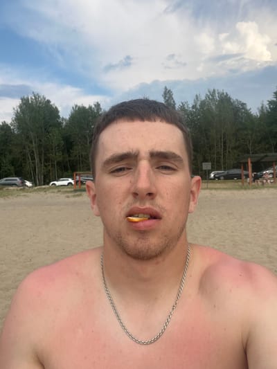 This is a close-up, vertically oriented selfie of a young man at a beach or sandy area. The man has short brown hair, light skin, and is wearing a silver chain necklace. He has a piece of orange or similar fruit in his mouth. His shoulders and upper chest are visible and appear sunburned, with areas of redness.
In the background, there is a sandy ground with some trees and foliage. Several cars are parked, and a wooden structure that looks like a beach shelter or pavilion is visible. Some people are faintly discernible near the shelter. The sky is visible in the upper portion of the image, with white clouds against a blue sky. The lighting suggests it is daytime, likely with bright sunlight given the sunburn.
The overall impression is a casual, outdoor setting, possibly a recreational area. The expression on the man's face is neutral or slightly playful, given the object in his mouth. There is no visible text in the image.
