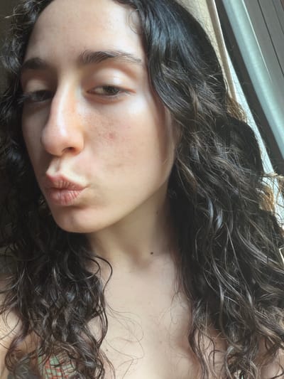 A young person with long, dark curly hair is lying down. Their head is tilted towards the viewer, with their lips pursed. The background includes a window frame at the top of the frame. There is no verifiable evidence to indicate the location is in Lissone, Italy.