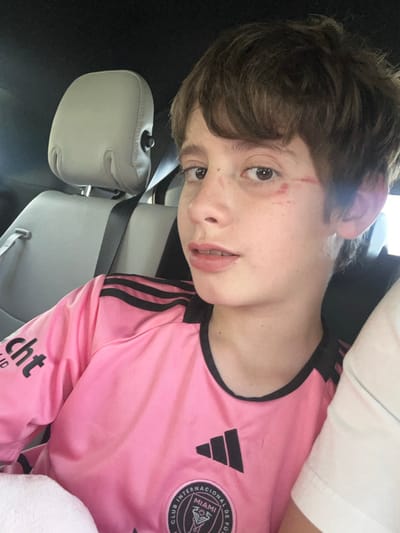 A young person with light brown hair, brown eyes, and minor facial abrasions wears a pink Inter Miami CF soccer jersey with black stripes and logo details. They are sitting in a car, with a grey leather car seat and headrest visible. A seatbelt crosses the scene diagonally. A glimpse of a white shirt is visible above the soccer jersey. The overall image has a candid, selfie-like quality.