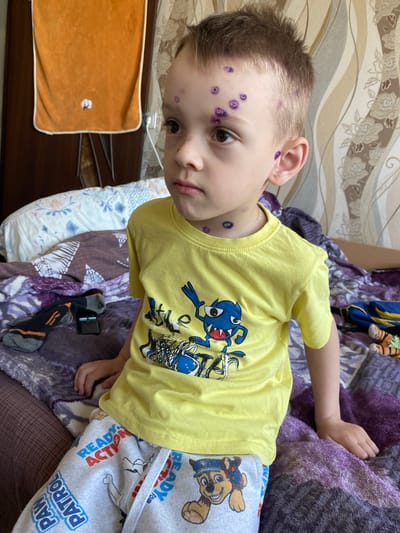 A young boy with short, spiky brown hair sits on a bed covered with purple and patterned blankets. He is wearing a yellow t-shirt with a cartoon monster graphic and light grey sweatpants featuring "Paw Patrol" characters. The boy's face and neck have several purple markings, possibly ink or paint. His right hand rests on the blanket, while his left arm is bent, with his elbow resting on his leg. In the background, a folded orange towel hangs on a wall, and patterned wallpaper is visible. To the left of the boy, a pair of black and orange socks and a small black electronic device lie on the blanket. To the right of the boy, a blue and yellow bag and some striped toy animals are partially visible. The scene appears to be indoors, likely in a residential setting. No specific location in Ihnatpil, Ukraine can be determined from the image alone.