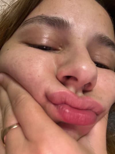 A close-up, head-on, slightly angled shot shows the face of a young female, her left hand cupping her cheek. Her eyes are closed, and her lips are pursed, creating a dimple in her left cheek. Her eyebrows are dark and well-defined. Her nose is prominent, and her skin appears smooth with some minor blemishes. A thin gold band is visible on her ring finger. The background is softly blurred, suggesting an indoor setting. There is no indication of the location being in Vyksa, Russia.