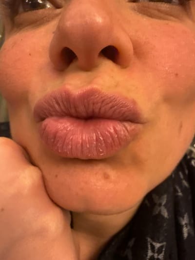 A close-up shot captures a face with prominent lips pursed in a kissing gesture. The skin appears fair with visible pores and a few small moles. The nose is large and somewhat shiny. The lips exhibit a noticeable texture with visible lines. Part of a dark patterned fabric is visible in the background, contrasting with the light skin tones. A hand or other body part is touching the side of the face. The image has a shallow depth of field, focusing primarily on the facial features.