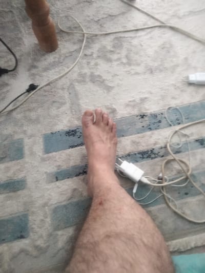 The image shows a person's lower leg and foot resting on a rug. The rug has a pattern of light blue and white rectangular blocks. There are several electronic cables and a white power adapter visible on the rug, suggesting the person is likely at home. The lighting appears to be indoor. The image is taken from a high-angle perspective, looking down at the leg and foot. No specific activity or event is depicted, but the presence of cables and a foot suggests a moment of rest or relaxation. The details about time of day, weather, emotions, and visible text are not discernible from the image. The provided location context of Qaskeleñ, Kazakhstan, does not offer any additional visual cues within the image itself.